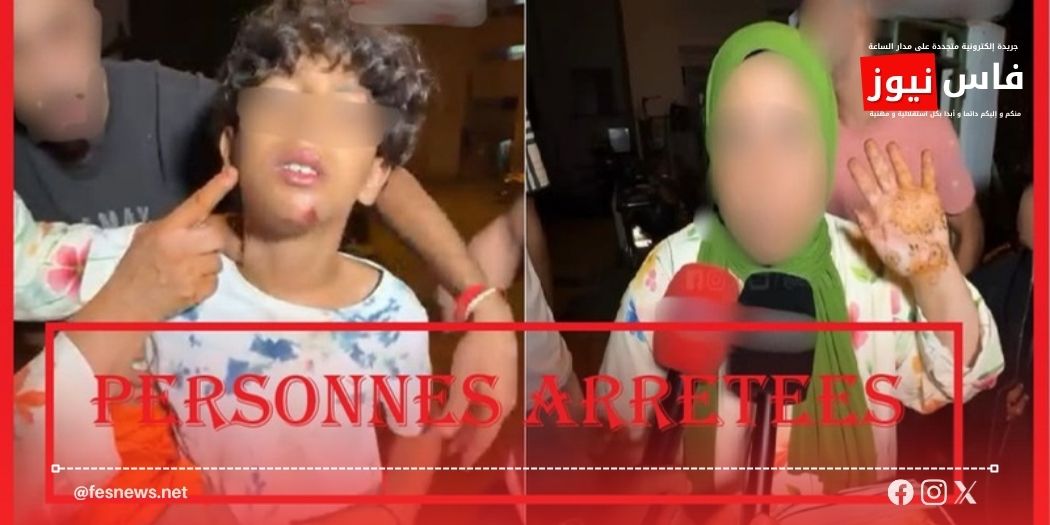 المديرية العامة للأمن الوطني 13 الجديدة.. توقيف 3 إيفواريين في قضية ضرب قاصر وفتح بحث حول ادعاءات التقاعس الأمني